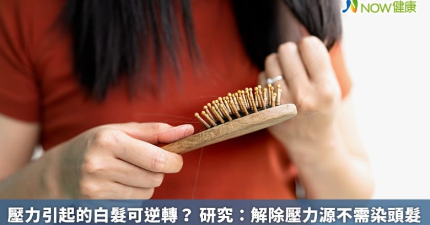 壓力引起的白髮可逆轉？ 研究：解除壓力源不需染頭髮