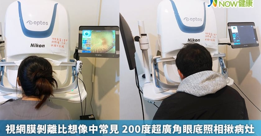 視網膜剝離比想像中常見 200度超廣角眼底照相揪病灶