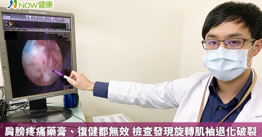 肩膀疼痛藥膏、復健都無效 檢查發現旋轉肌袖退化破裂