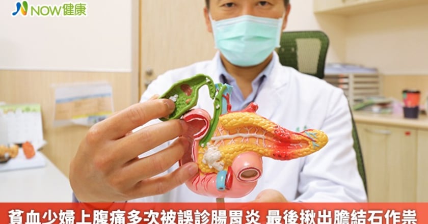 貧血少婦上腹痛多次被誤診腸胃炎 最後揪出膽結石作祟
