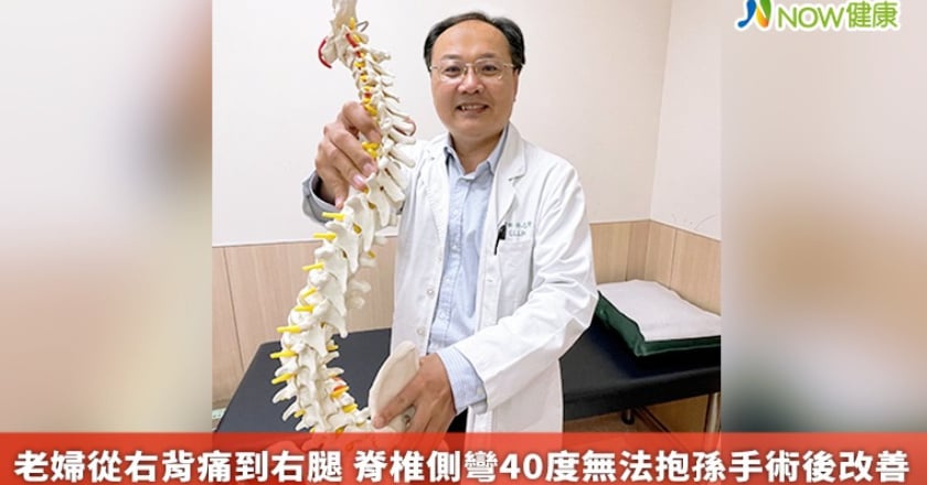 老婦從右背痛到右腿 脊椎側彎40度無法抱孫手術後改善