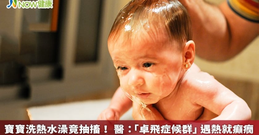 寶寶洗熱水澡竟抽搐! 醫:「卓飛症候群」遇熱就癲癇