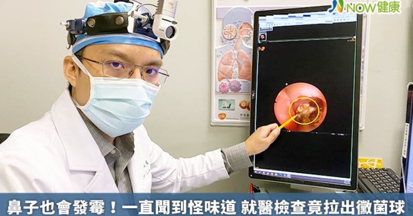 鼻子也會發霉!一直聞到怪味道 就醫檢查竟拉出黴菌球