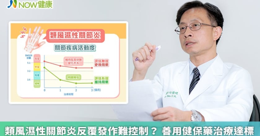 類風濕性關節炎反覆發作難控制? 善用健保藥治療達標