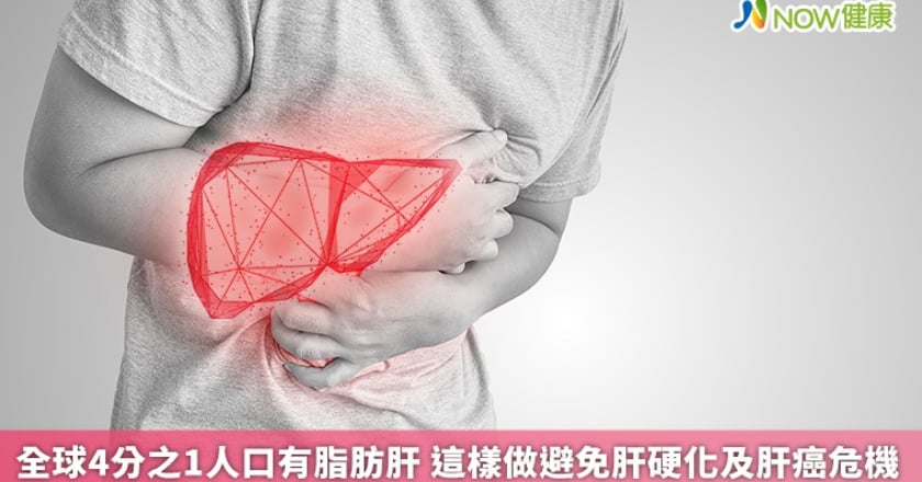 全球4分之1人口有脂肪肝 這樣做避免肝硬化及肝癌危機