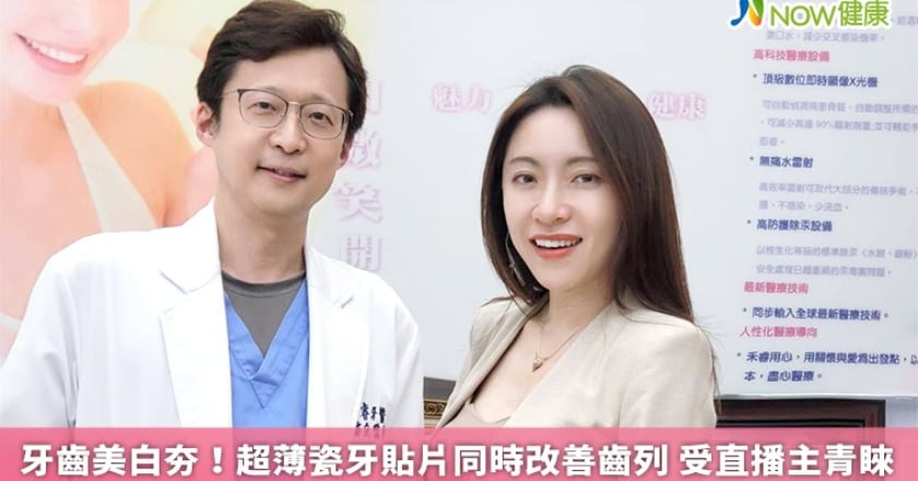 牙齒美白夯!超薄瓷牙貼片同時改善齒列 受直播主青睞