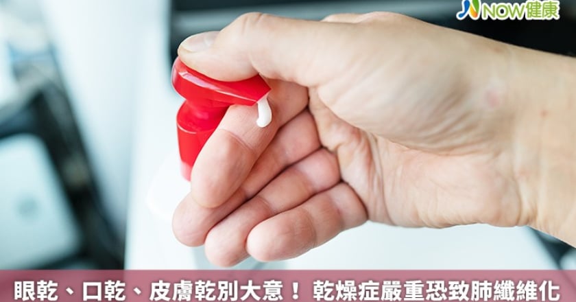 眼乾、口乾、皮膚乾別大意！ 乾燥症嚴重恐致肺纖維化