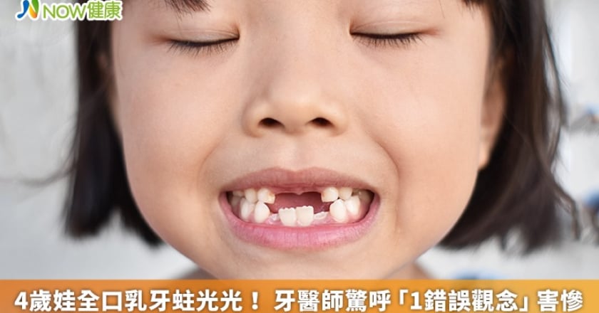 4歲娃全口乳牙蛀光光! 牙醫師驚呼「1錯誤觀念」害慘