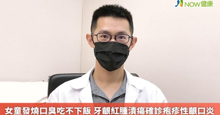 女童發燒口臭吃不下飯 牙齦紅腫潰瘍確診疱疹性齦口炎