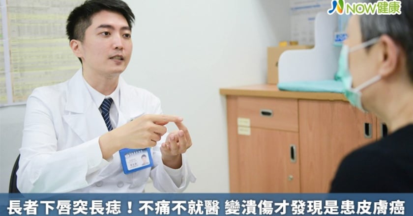 長者下唇突長痣！不痛不就醫 變潰傷才發現是患皮膚癌