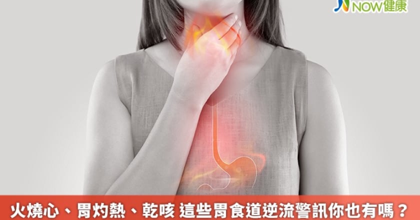 火燒心、胃灼熱、乾咳 這些胃食道逆流警訊你也有嗎？