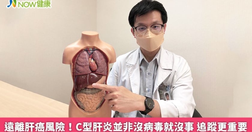 遠離肝癌風險!C型肝炎並非沒病毒就沒事 追蹤更重要