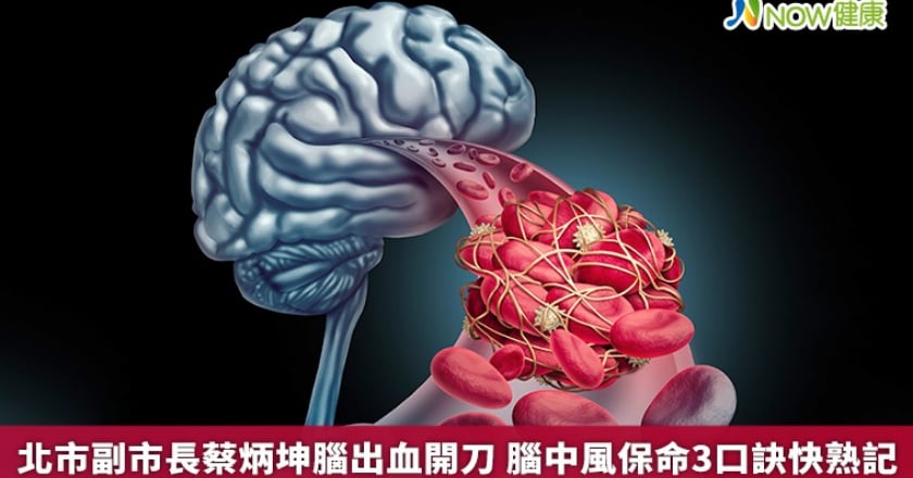 北市副市長蔡炳坤腦出血開刀 腦中風保命3口訣快熟記