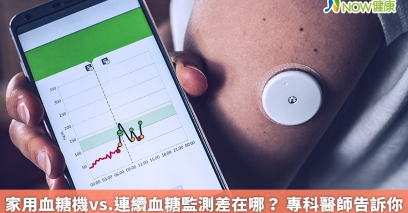 家用血糖機vs.連續血糖監測差在哪？ 專科醫師告訴你