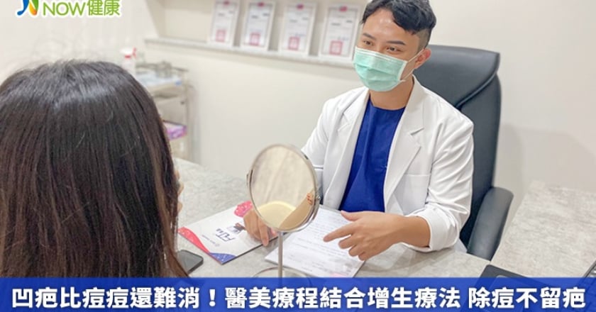 凹疤比痘痘還難消！醫美療程結合增生療法 除痘不留疤