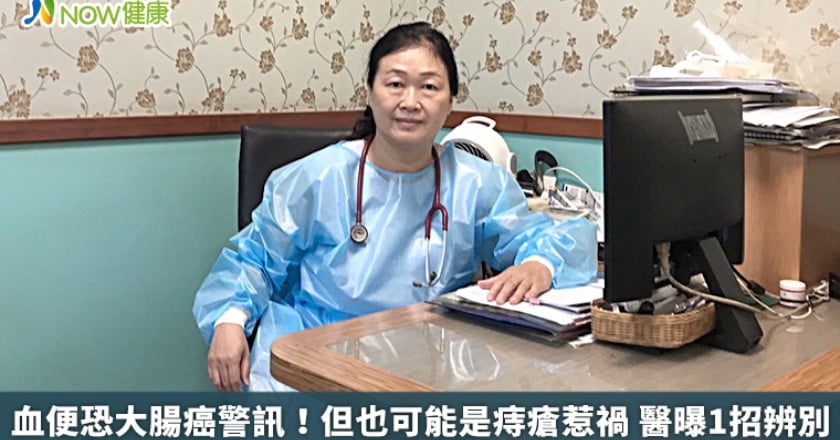 血便恐大腸癌警訊!但也可能是痔瘡惹禍 醫曝1招辨別