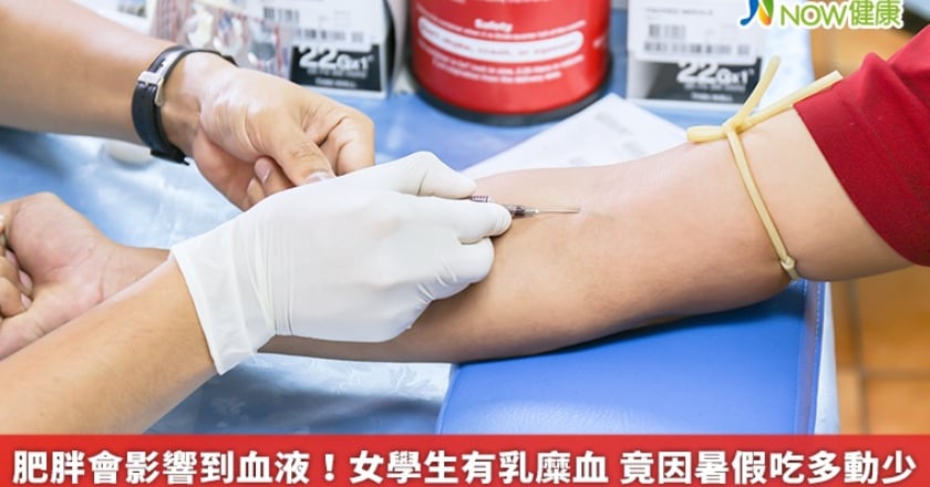 肥胖會影響到血液!女學生有乳糜血 竟因暑假吃多動少