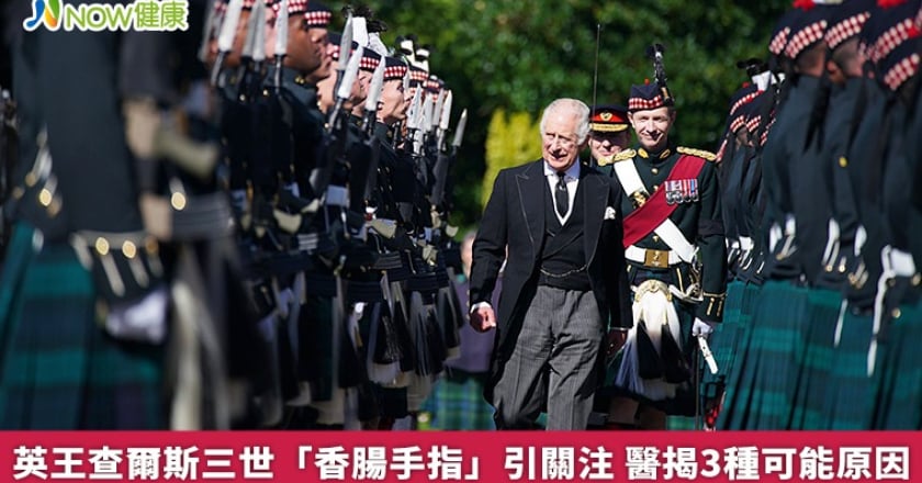 英王查爾斯三世「香腸手指」引關注 醫揭3種可能原因