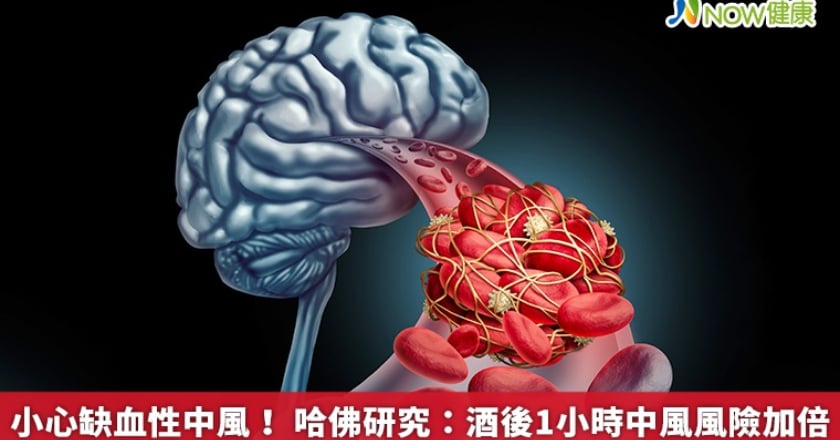 小心缺血性中風! 哈佛研究:酒後1小時中風風險加倍