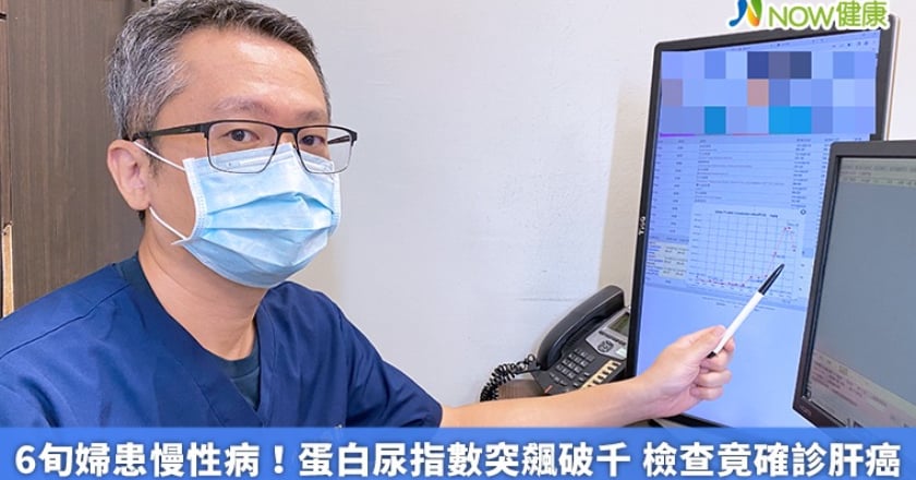 6旬婦患慢性病！蛋白尿指數突飆破千 檢查竟確診肝癌