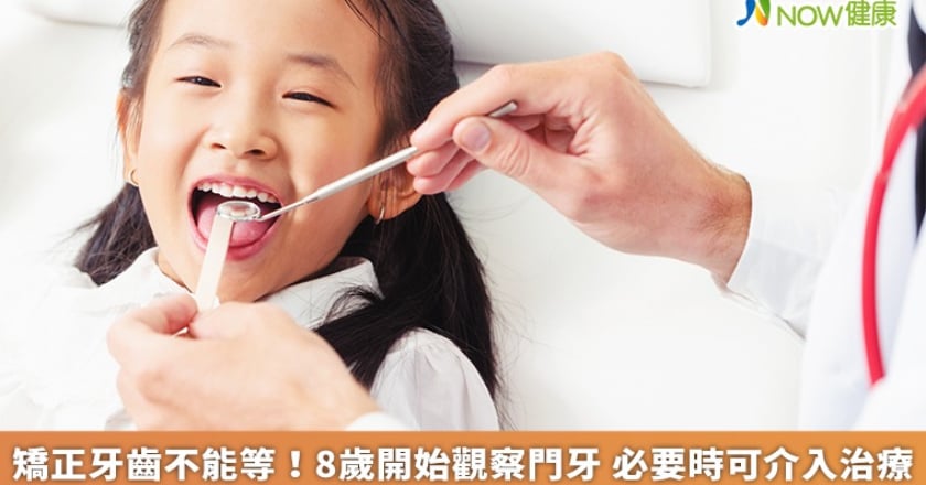 矯正牙齒不能等!8歲開始觀察門牙 必要時可介入治療
