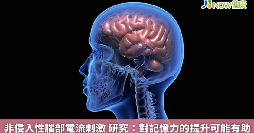 非侵入性腦部電流刺激 研究：對記憶力的提升可能有助