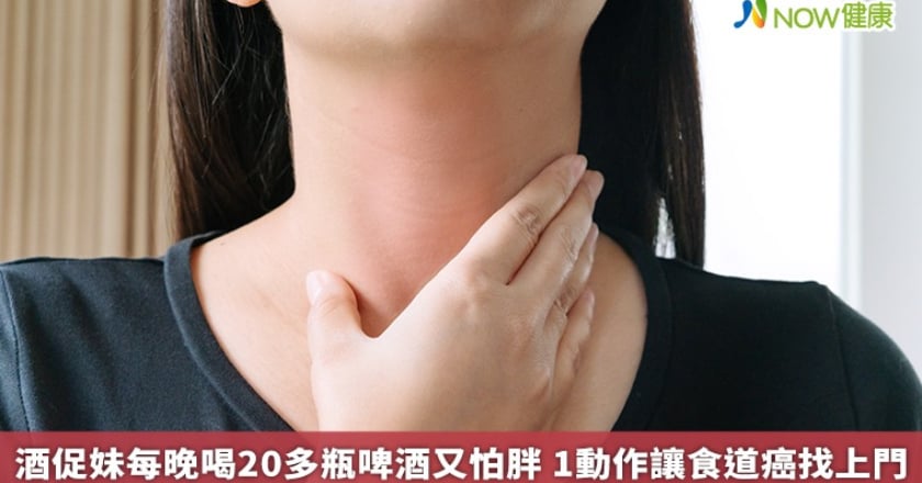 酒促妹每晚喝20多瓶啤酒又怕胖 1動作讓食道癌找上門