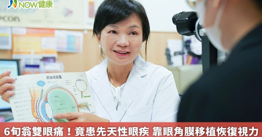 6旬翁雙眼痛！竟患先天性眼疾 靠眼角膜移植恢復視力