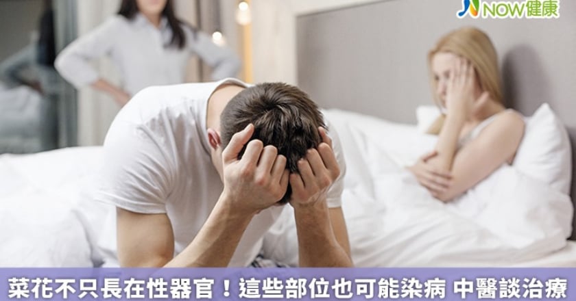 菜花不只長在性器官！這些部位也可能染病 中醫談治療