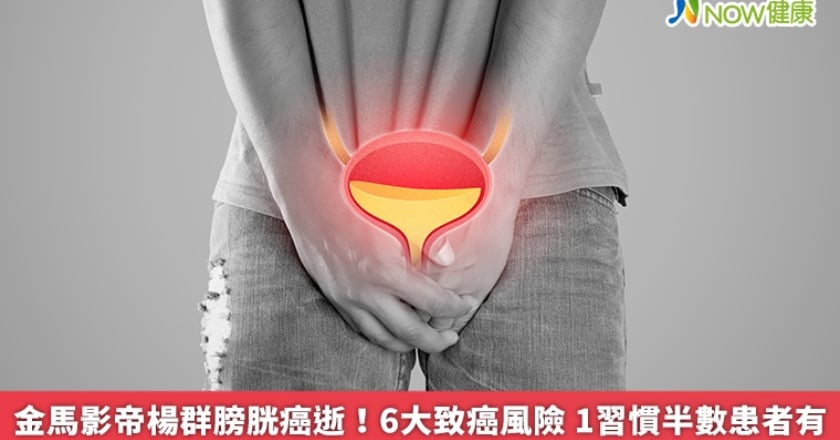 金馬影帝楊群膀胱癌逝！6大致癌風險 1習慣半數患者有