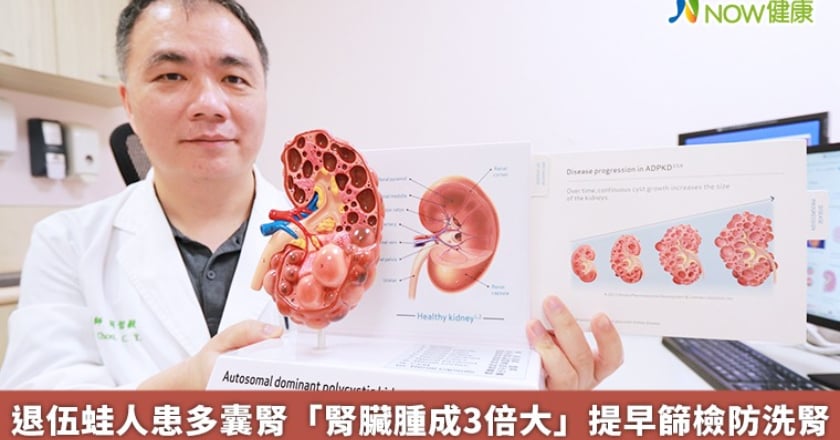 退伍蛙人患多囊腎 「腎臟腫成3倍大」 提早篩檢防洗腎