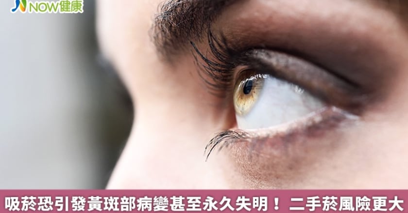 吸菸恐引發黃斑部病變甚至永久失明! 二手菸風險更大