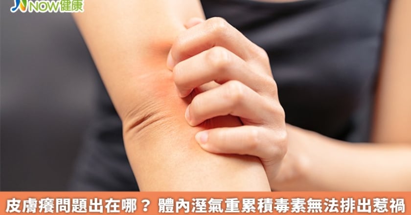 皮膚癢問題出在哪？ 體內溼氣重累積毒素無法排出惹禍