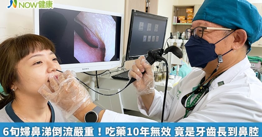 6旬婦鼻涕倒流嚴重！吃藥10年無效 竟是牙齒長到鼻腔