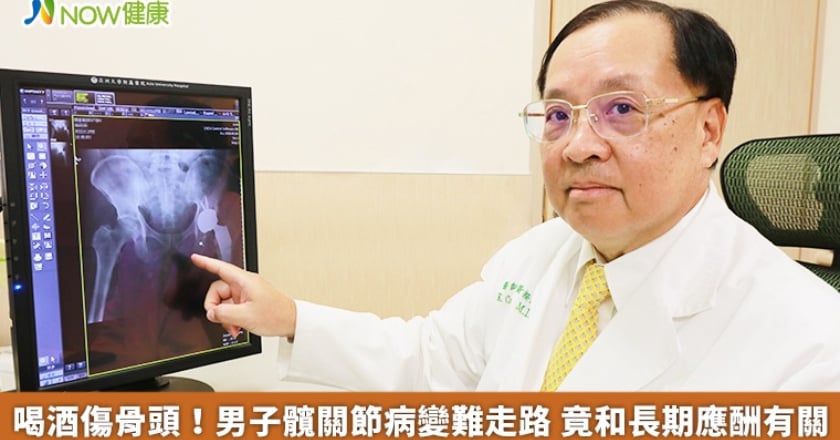 喝酒傷骨頭！男子髖關節病變難走路 竟和長期應酬有關