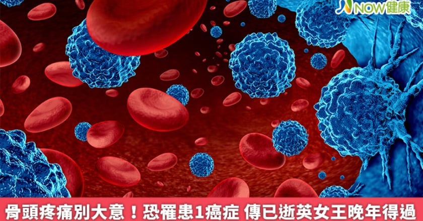 骨頭疼痛別大意!恐罹患1癌症 傳已逝英女王晚年得過