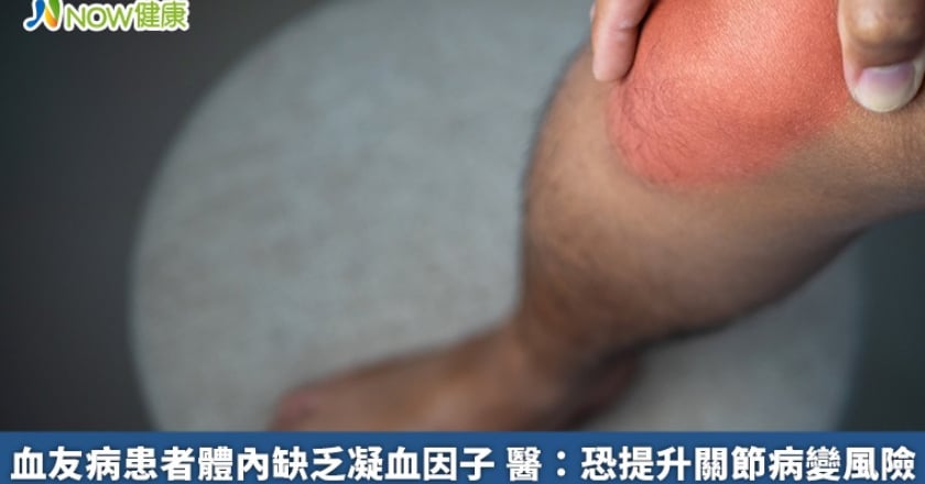 血友病患者體內缺乏凝血因子 醫：恐提升關節病變風險