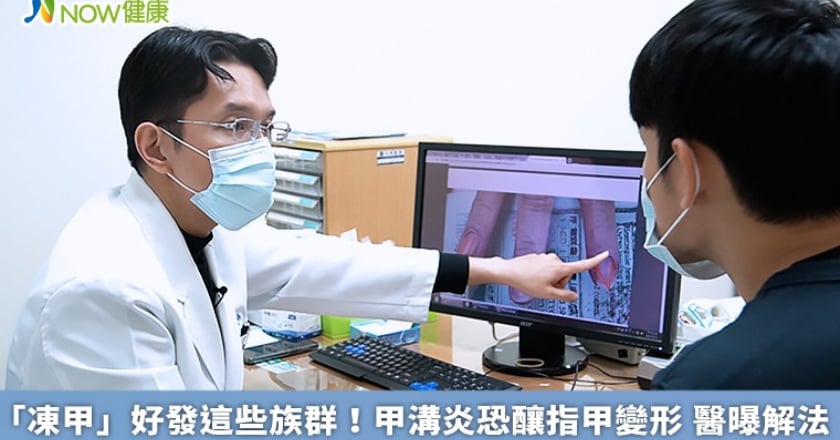 「凍甲」好發這些族群!甲溝炎恐釀指甲變形 醫曝解法