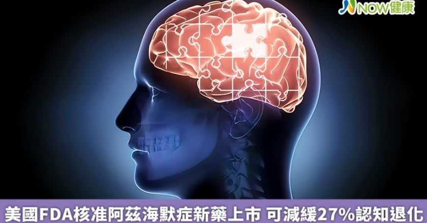 美國FDA核准阿茲海默症新藥上市 可減緩27%認知退化