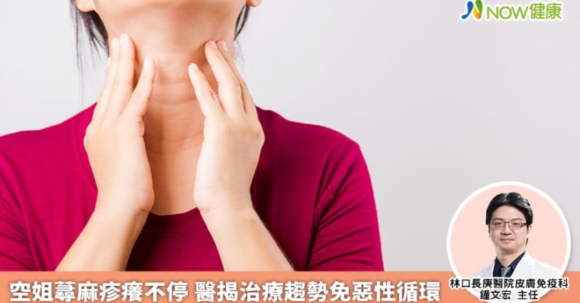 空姐蕁麻疹癢不停 醫揭治療趨勢免惡性循環