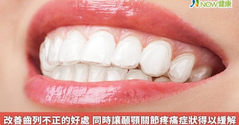 改善齒列不正的好處 同時讓顳顎關節疼痛症狀得以緩解