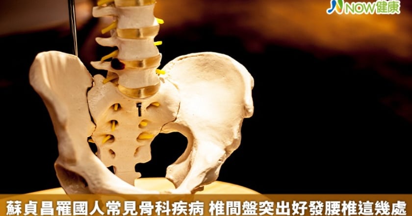 蘇貞昌罹國人常見骨科疾病 椎間盤突出好發腰椎這幾處