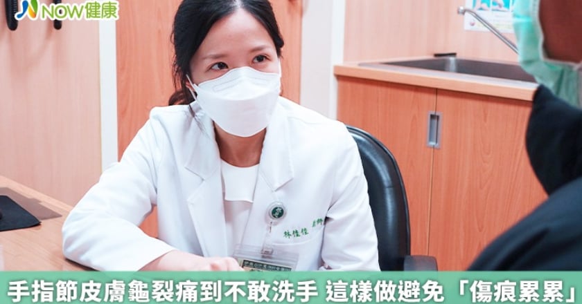 手指節皮膚龜裂痛到不敢洗手 這樣做避免「傷痕累累」