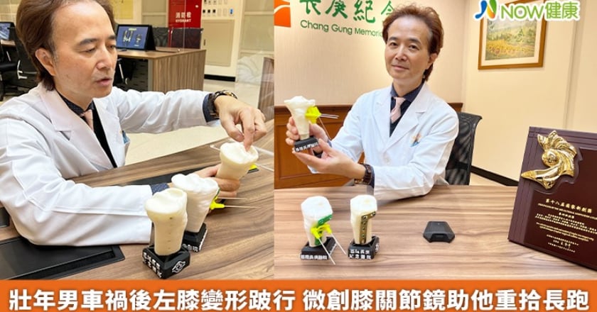 壯年男車禍後左膝變形跛行 微創膝關節鏡助他重拾長跑