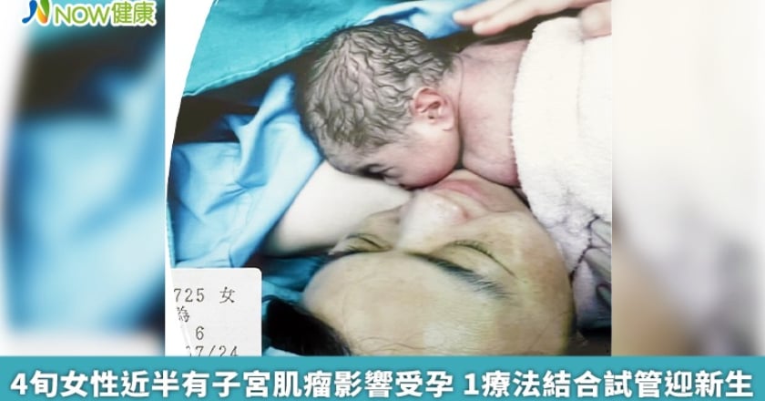 4旬女性近半有子宮肌瘤影響受孕 1療法結合試管迎新生