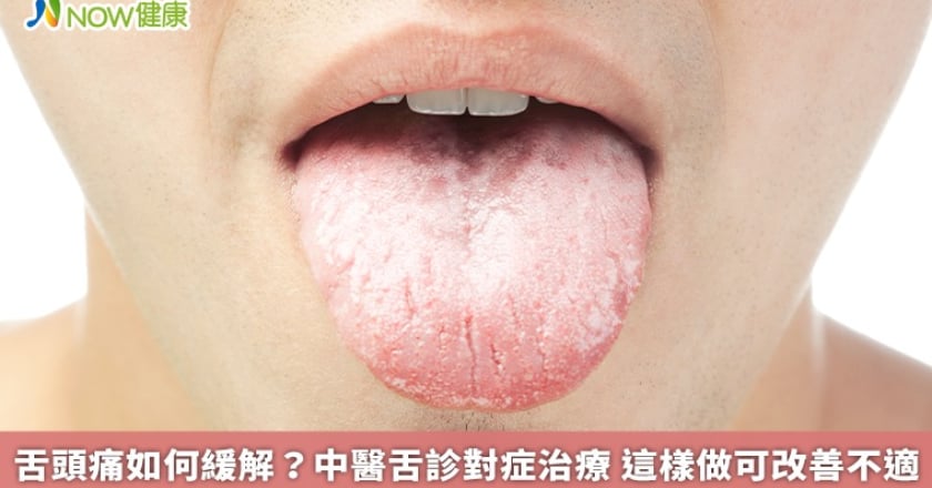 舌頭痛如何緩解？中醫舌診對症治療 這樣做可改善不適