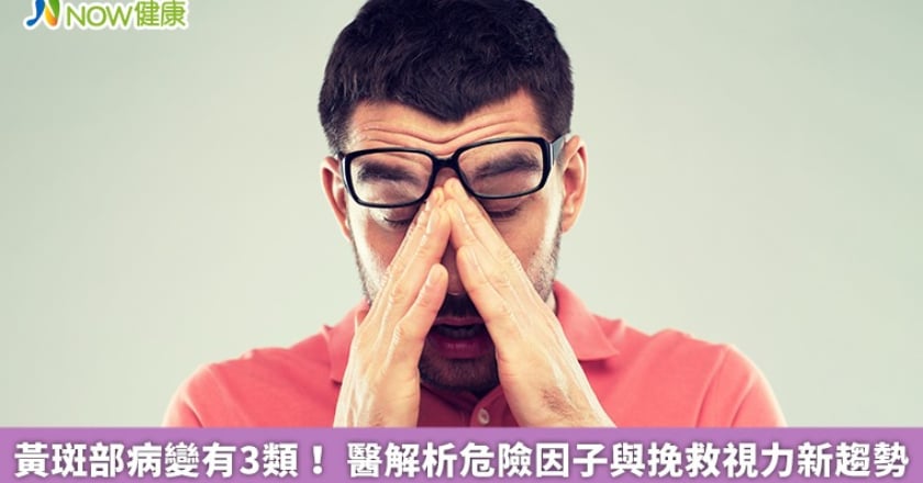 黃斑部病變有3類! 醫解析危險因子與挽救視力新趨勢