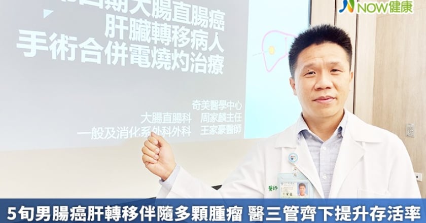 5旬男腸癌肝轉移伴隨多顆腫瘤 醫三管齊下提升存活率