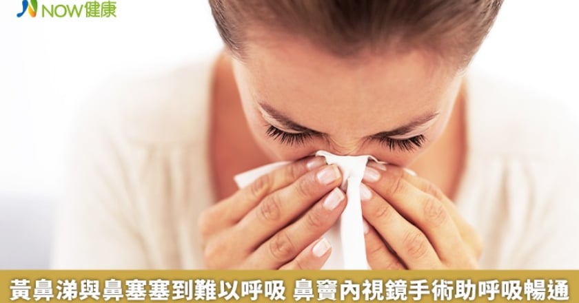 黃鼻涕與鼻塞塞到難以呼吸 鼻竇內視鏡手術助呼吸暢通