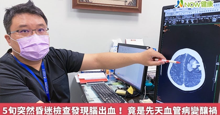 5旬突然昏迷檢查發現腦出血！ 竟是先天血管病變釀禍
